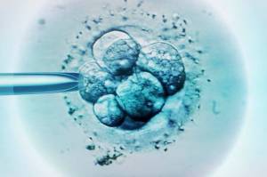 Ilmuwan Berhasil Kembangkan Embrio Manusia Tanpa Sel Telur Wanita