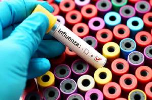 Vaksin Influenza Efektif Mencegah Infeksi dan Komplikasi Virus Influenza