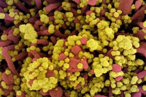 Temuan Baru, Mutasi COVID-19 Mungkinkan Virus Hindari Serangan Antibodi