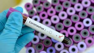 Uji Klinis Vaksin Covid-19 Made in China Digelar di 6 Tempat di Bandung