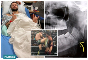 Cedera Horor, Rahang Pegulat WWE Ini Hancur Dihajar Lawan