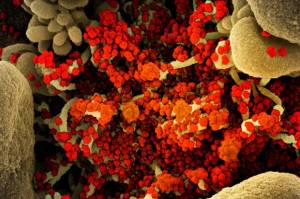 Gesit, Virus Corona Bisa Melompat Langsung dari Kelelawar ke Manusia