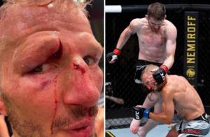 Alis Mata Petarung UFC Ini Terbelah Dihantam Lutut Seterunya