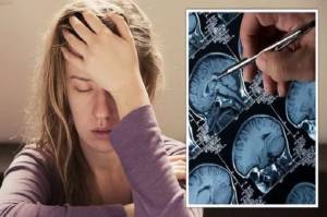 Migrain, 7 Tanda Sakit Kepala yang Mengancam Jiwa