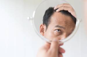 5 Cara Alami untuk Atasi Kebotakan akibat Rambut Rontok
