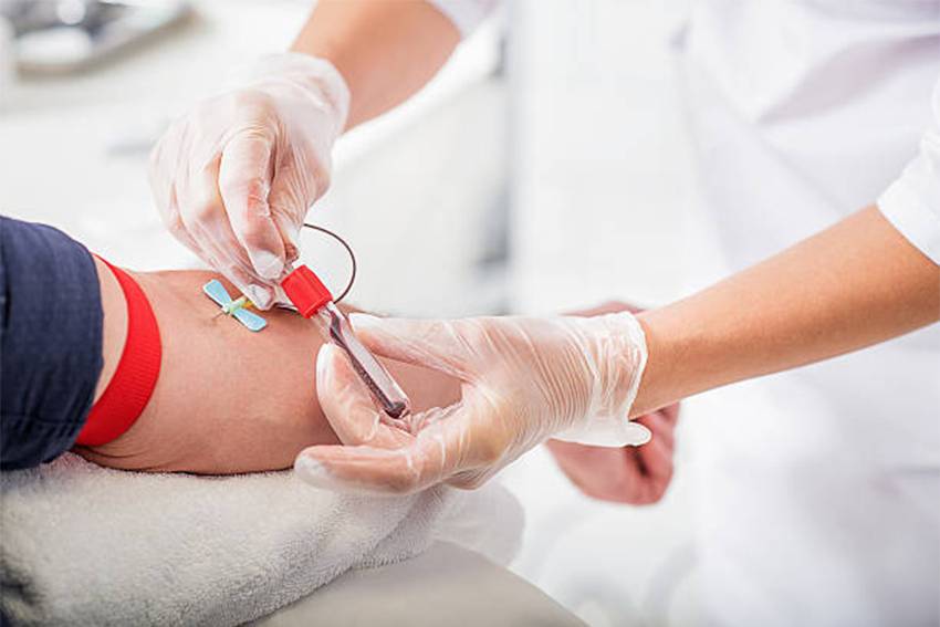 9 Manfaat Donor Darah bagi Kesehatan, Salah Satunya Turunkan Risiko Penyakit Jantung