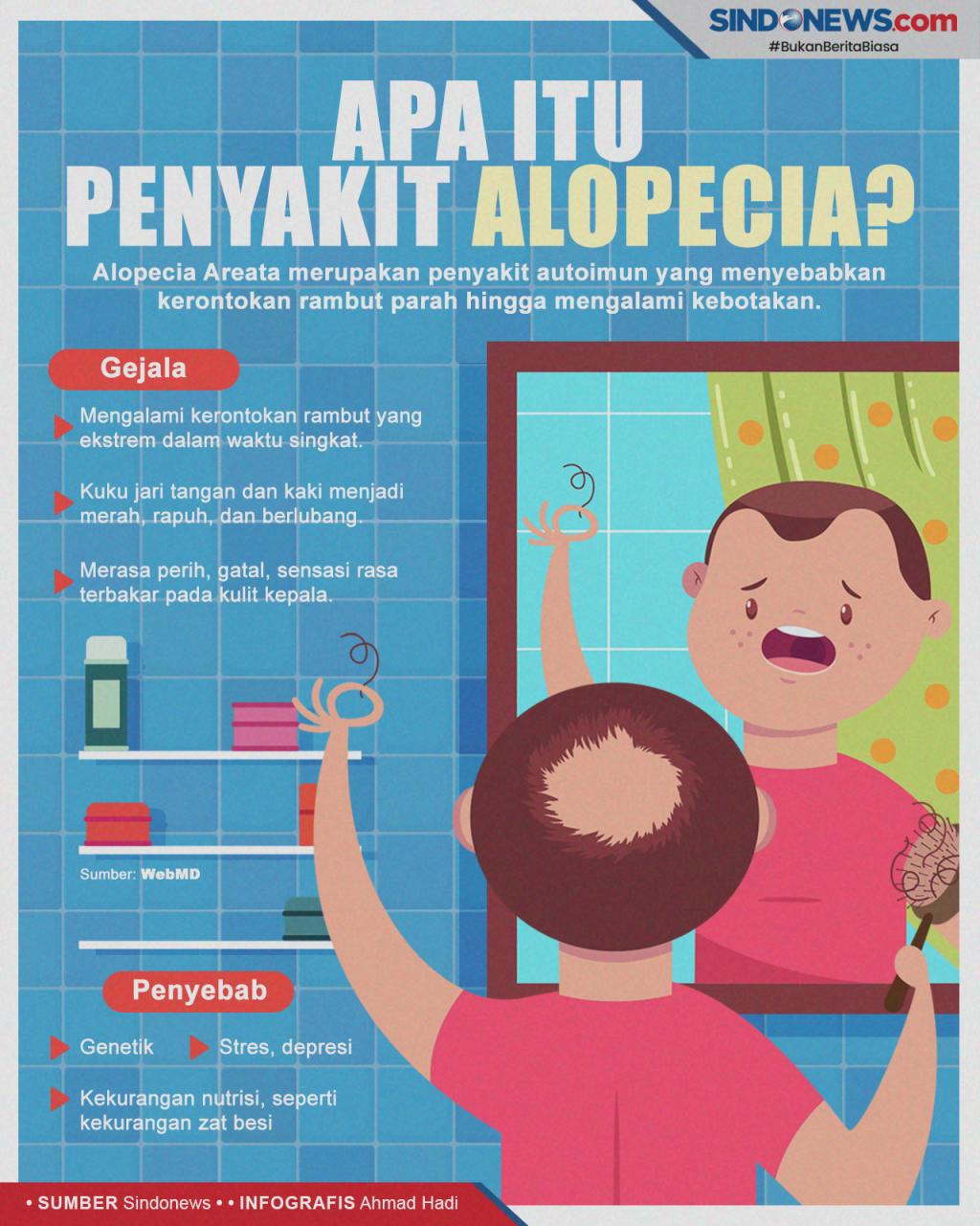 Alopecia penyakit apa
