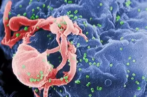 Ilmuwan Temukan Varian Baru Virus HIV Lebih Mematikan dan Lebih Cepat Menular
