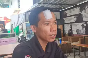 Aksi Heroik Tukang Pangkas Rambut Lawan Rampok di Cengkareng: Lumayan 5 Jahitan!