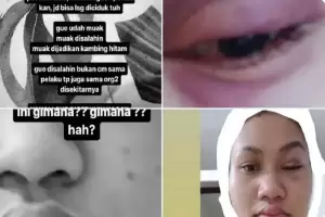 Istri Jadi Korban KDRT Suami Selama 8 Tahun di Bekasi, Polisi: Mereka Udah Baikan!