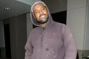 Kanye West Pakai Gigi Palsu Titanium Seharga Rp13 Miliaran, Netizen Malah Nyinyir