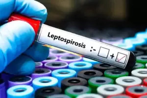 Waspada Penyakit Leptospirosis saat Musim Penghujan